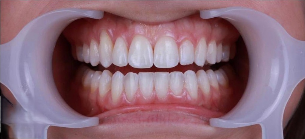 Case 01 After