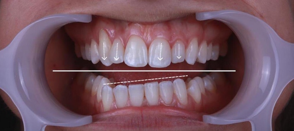 Case 01 After