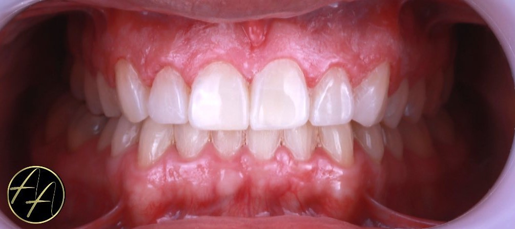 Case 01 After