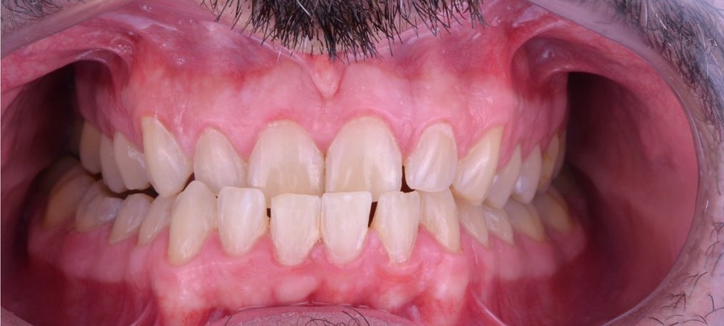 Case 01 After
