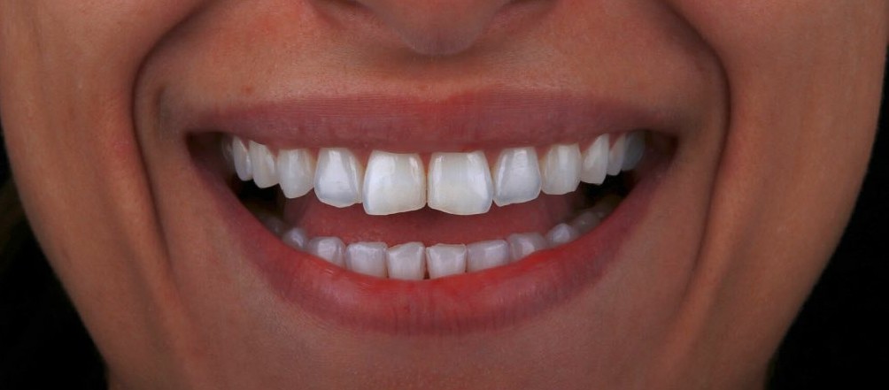 Case 01 After